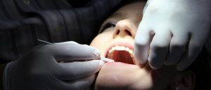 5 Common Dental Problems and its Symptoms