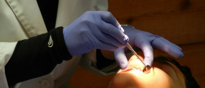 7 Things To Do After Tooth Extraction